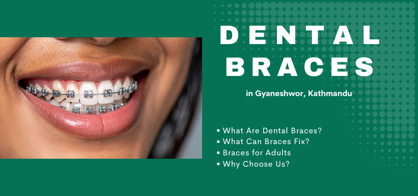 Dental Braces Treatment