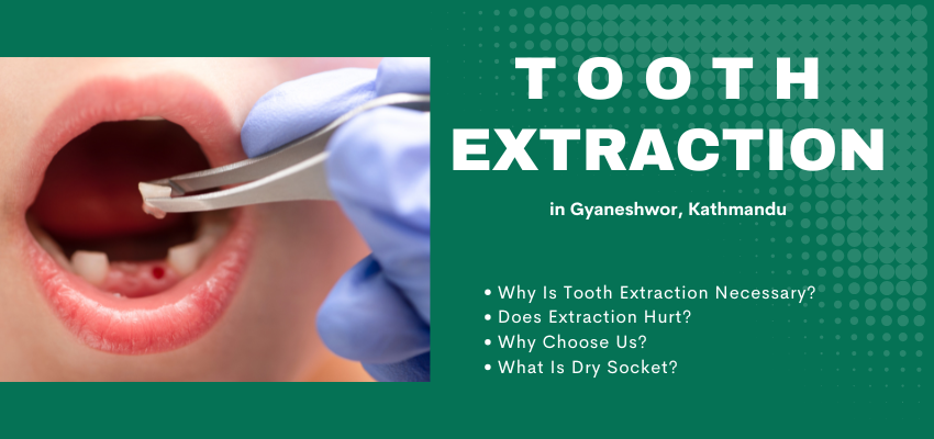 Tooth Extraction Procedure